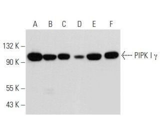 PIPK I &gamma; Antibody (F-11) - Western Blotting - Image 357952 