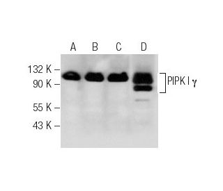 PIPK I &gamma; Antibody (H-9) - Western Blotting - Image 281401 