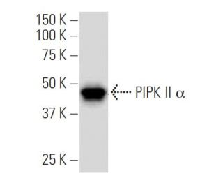 PIPK II &alpha; Antibody (149.1) - Western Blotting - Image 33780 