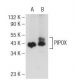 PIPOX Antibody (F-9) - Western Blotting - Image 108838 