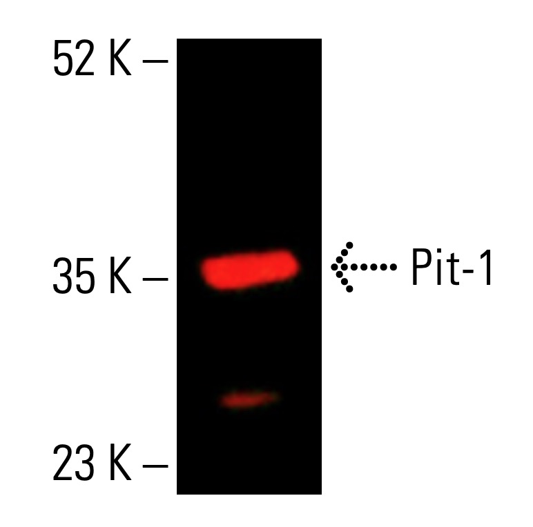 Pit-1抗体(D-7) | SCBT - Santa Cruz Biotechnology