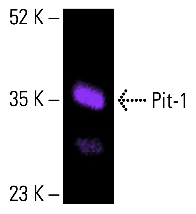 たんたんです Pit-1抗体(D-7) | SCBT - Santa Cruz Biotechnology