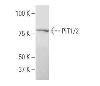 PiT1/2 Antibody (SY-12) - Western Blotting - Image 34655The Double Nickase Plasmid features a U6 promoter for sgRNA expression, a 20 nt targeting sequence, and a gRNA scaffold to guide Cas9n. It includes a CBh promoter for Cas9n (D10A) and puromycin resistance, GFP for transfection verification, and nuclear localization signals (NLS). The 2A peptide allows co-expression of Cas9n and Puro from a single promoter, enabling precise genome editing with reduced off-target effects.
