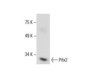 western blotting image from recommended Pitx2 (H-1) monoclonal antibody replacement. Image 288596