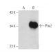 Pitx2 Antibody (H-1) - Western Blotting - Image 389171