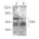 PJA2 Antibody (A-4) - Western Blotting - Image 287214