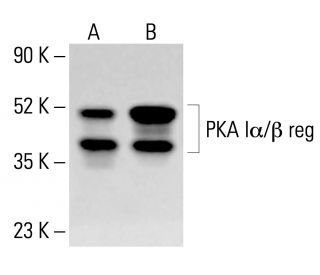 PKA Iα/β reg Antibody (B-6) - Western Blotting - Image 413885