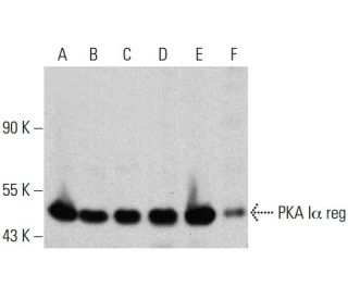 PKA Iα reg Antibody (20) - Western Blotting - Image 385759Each CRISPR/Cas9 Knockout (KO) Plasmid product consists of a pool of 3 plasmids designed to ensure identification and cleavage of a specific gene for maximum knockout efficiency. Each plasmid encodes a unique 20 nt sequence derived from the GeCKO (v2) library.