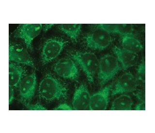 pka-ialpha-beta-reg-antibody-b