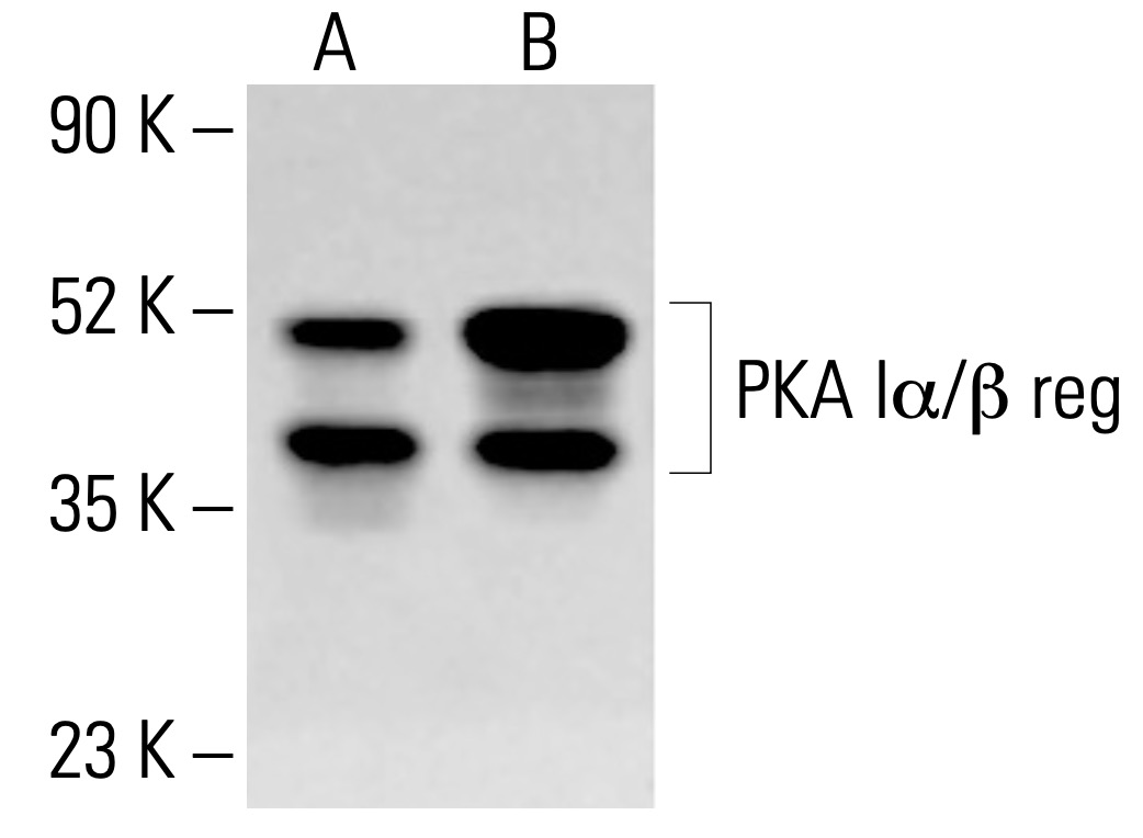 PKA Iα/β reg Antibody (B-6) | SCBT - Santa Cruz Biotechnology