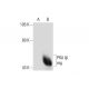 PKA Iα/β reg Antibody (G-6) - Western Blotting - Image 134059