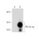 PKA Iα/β reg Antibody (G-6) - Western Blotting - Image 134736 
