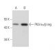 PKA Iα/β reg Antibody (G-6) - Western Blotting - Image 356918 