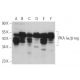 western blotting image from recommended PKA Iα/β reg (B-6) monoclonal antibody replacement. Image 360718