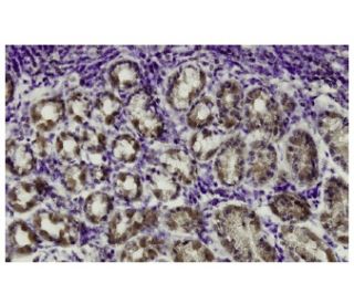 immunohistochemistry image from recommended PKA I&beta; reg (QR-7) monoclonal antibody replacement. Image 36012