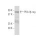 PKA Iβ reg Antibody (QR-7) - Western Blotting - Image 33787