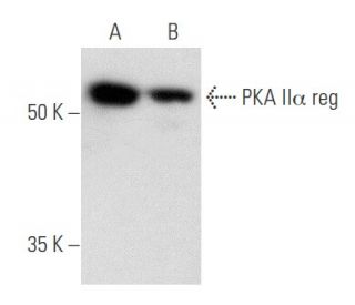 western blotting image from recommended PKA II&alpha; reg (H-12) monoclonal antibody replacement. Image 356541