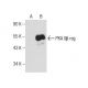 PKA IIβ reg Antibody (C-2) - Western Blotting - Image 159014