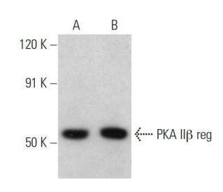 PKA II&beta; reg Antibody (C-2) - Western Blotting - Image 358564 