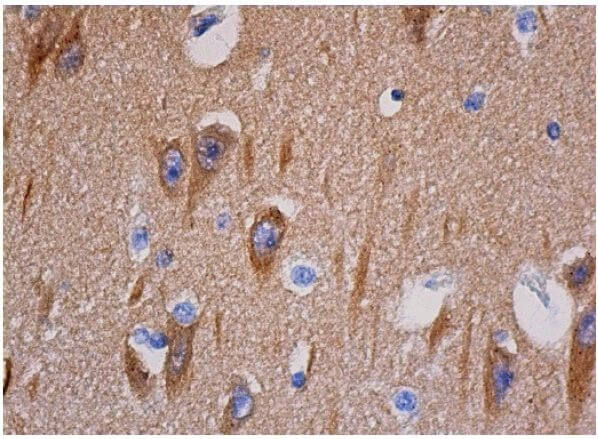 ◆Cat◆ PKAα cat Antibody (A-2) | SCBT - Santa Cruz Biotechnology