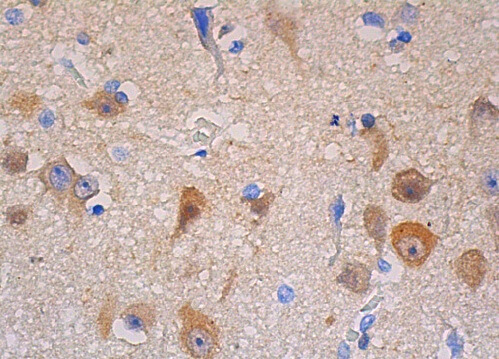 【ふぅ〜か！】　SC-126 p53 (DO-1) Alexa Fluor® 594 Antibody sc-126 AF594 from Santa