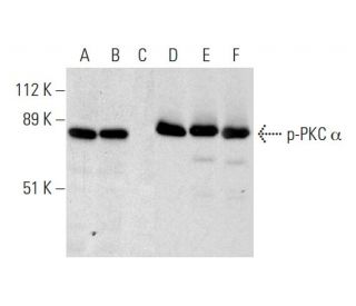 western blotting image from recommended PKC alpha (H-7) monoclonal antibody replacement. Image 297898