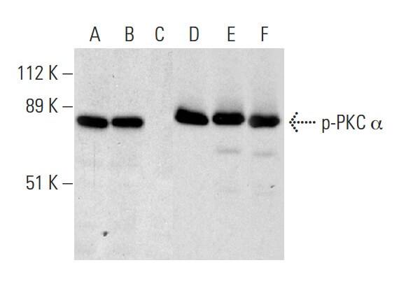 PKC α Antibody (C-20) | SCBT - Santa Cruz Biotechnology