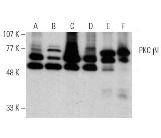 western blotting image from recommended PKC beta 1 (E-3) monoclonal antibody replacement. Image 370728
