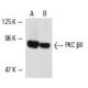 western blotting image from recommended PKC beta 2 (F-7) monoclonal antibody replacement. Image 2002