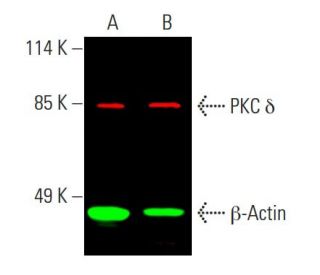 western blotting image from recommended PKC delta (G-9) monoclonal antibody replacement. Image 387583