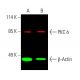 This polyclonal antibody has been discontinued. See our recommended <a href="pkc-delta-antibody-g-9">PKC delta (G-9)</a> monoclonal antibody (sample data shown). western blotting image from recommended PKC delta (G-9) monoclonal antibody replacement. Image 387583