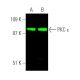 This polyclonal antibody has been discontinued. See our recommended <a href="pkc-epsilon-antibody-e-5">PKC epsilon (E-5)</a> monoclonal antibody (sample data shown). western blotting image from recommended PKC epsilon (E-5) monoclonal antibody replacement. Image 374295