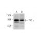 PKC gamma Antibody (D-4) - Western Blotting - Image 377475 