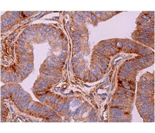 immunohistochemistry image from recommended PKC lambda/iota (E-7) monoclonal antibody replacement. Image 369606