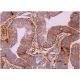 immunohistochemistry image from recommended PKC lambda/iota (E-7) monoclonal antibody replacement. Image 369606