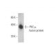 western blotting image from recommended PKC mu (G-9) monoclonal antibody replacement. Image 392832