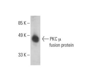 western blotting image from recommended PKC mu (G-9) monoclonal antibody replacement. Image 392832