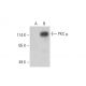 PKC mu Antibody (G-9) - Western Blotting - Image 392833