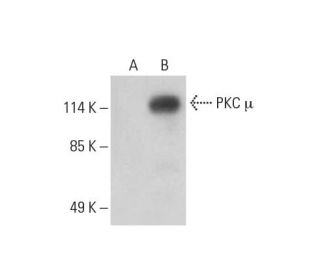 PKC mu Antibody (G-9) - Western Blotting - Image 392833SAM Transcription Activation: SAM system utilizing dCas9-VP64, MS2-P65-HSF1, and sgRNA for precise gene transcription activation.