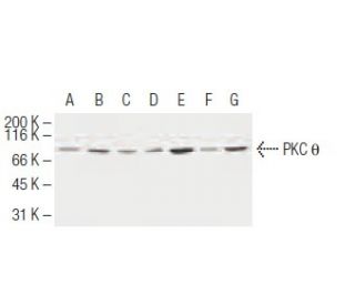 PKC theta Antibody (1C2) - Western Blotting - Image 62947 