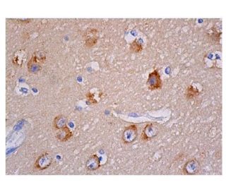 PKC zeta Antibody (H-1) | SCBT - Santa Cruz Biotechnology