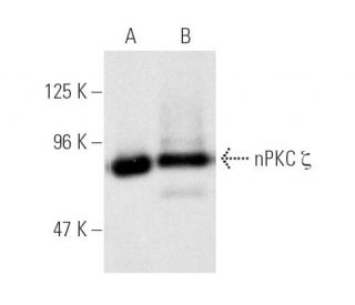 PKC zeta Antibody (H-1) | SCBT - Santa Cruz Biotechnology