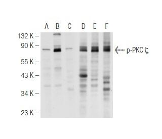 PKC zeta Antibody (H-1) | SCBT - Santa Cruz Biotechnology