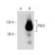 PKD2 Antibody (H-6) - Western Blotting - Image 149228