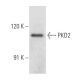 PKD2 Antibody (H-6) - Western Blotting - Image 357335 