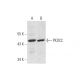 PKDCC Antibody (G-10) - Western Blotting - Image 320899
