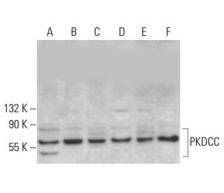 PKDCC Antibody (G-10) - Western Blotting - Image 383957The Double Nickase Plasmid features a U6 promoter for sgRNA expression, a 20 nt targeting sequence, and a gRNA scaffold to guide Cas9n. It includes a CBh promoter for Cas9n (D10A) and puromycin resistance, GFP for transfection verification, and nuclear localization signals (NLS). The 2A peptide allows co-expression of Cas9n and Puro from a single promoter, enabling precise genome editing with reduced off-target effects.