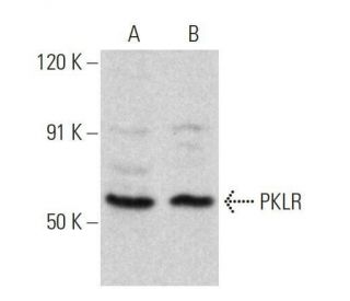 PKLR Antibody (D-10) - Western Blotting - Image 358672 