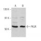 PKLR Antibody (D-10) - Western Blotting - Image 358672 