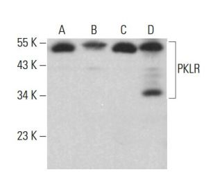 PKLR Antibody (E-2) - Western Blotting - Image 379950 